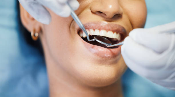 Best Emergency Dentist for Lost Fillings or Crowns in North Salt Lake, UT